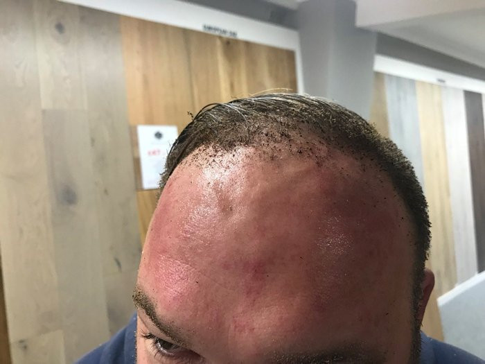 Londra'da son dakika patlama olay yerinden ilk görüntüler - Resim: 3