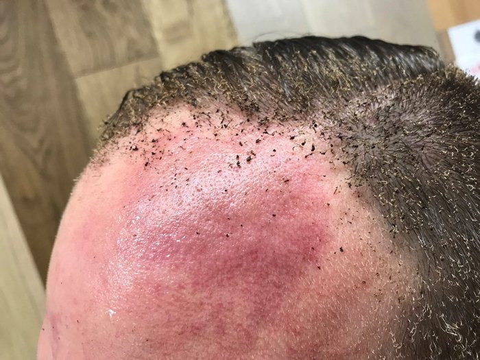 Londra'da son dakika patlama olay yerinden ilk görüntüler - Resim: 4