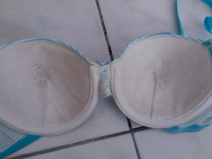 İç çamaşırı satın alıp giydi göğsü böcek yuvasına dönüştü inanılmaz kare! - Resim: 3