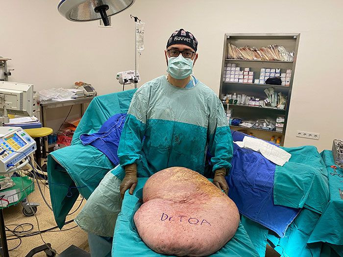 Görüntü inanılmaz! Kasığından 35 kiloluk kitle çıktı görenler inanamadı - Resim: 4