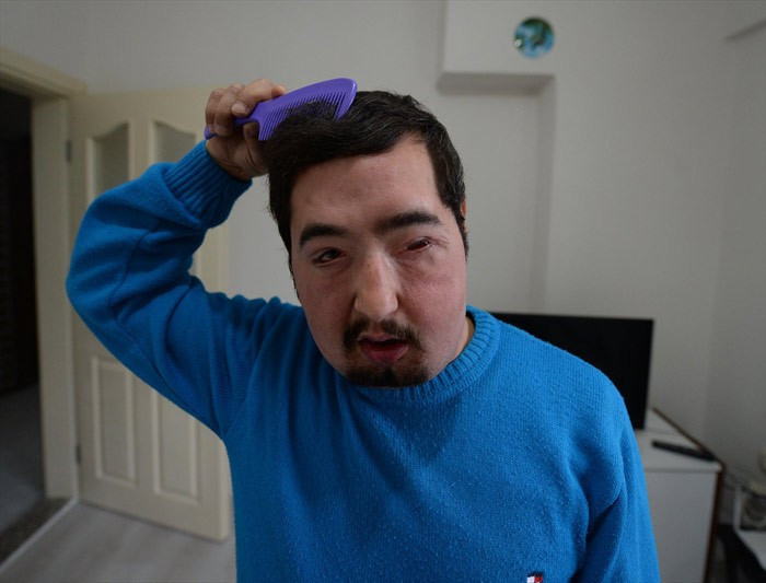 39 yaşında ama yüzü 23 yaşında - Resim: 4