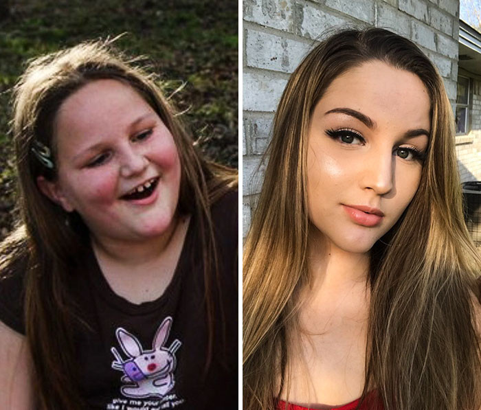 Muhteşem değişim! Onu bir de şimdi görün - Resim: 4