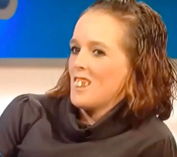 Dişleri alay konusu olunca bakın ne yaptı - Resim: 1