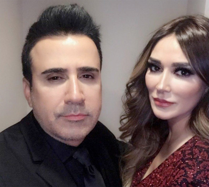 Emrah'ı görenler şoke oluyor botoks yaptırdı son hali bomba - Resim: 4