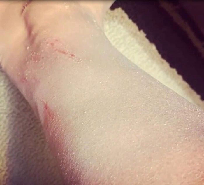 Esra Dermancıoğlu'nun hastalığı korkuttu atak gelince vücudunu kanatana kadar... - Resim: 4