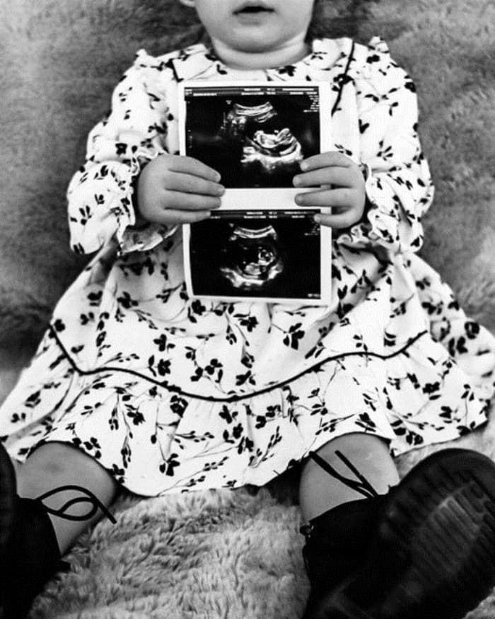 Hakan Çalhanoğlu ve Sinem Çalhanoğlu çiftinden müjdeli haber geldi - Resim: 2