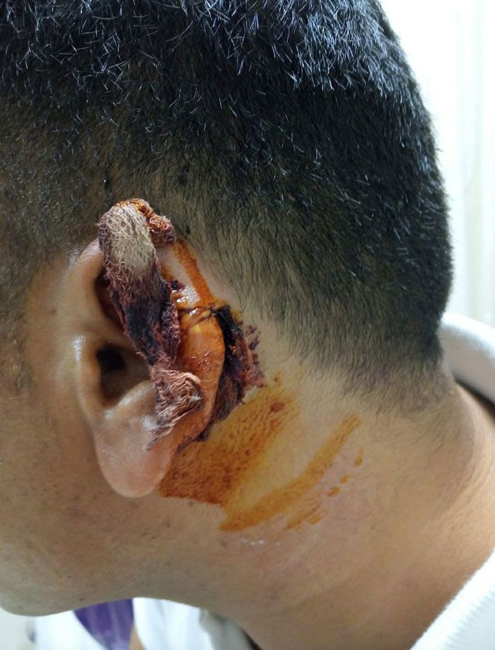 Kavgada kopan kulak parçasını martı kaptı - Resim: 4