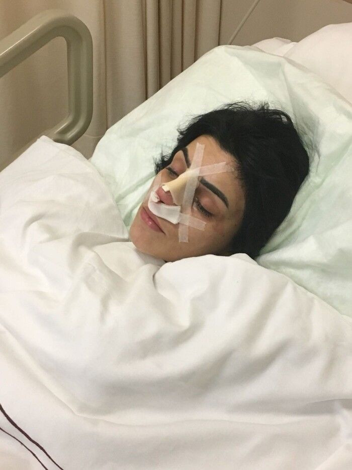 İstanbul'da aynaya bakmak istemiyor dokununca sarkıp katlanıyor! Gece açık şekilde... - Resim: 4