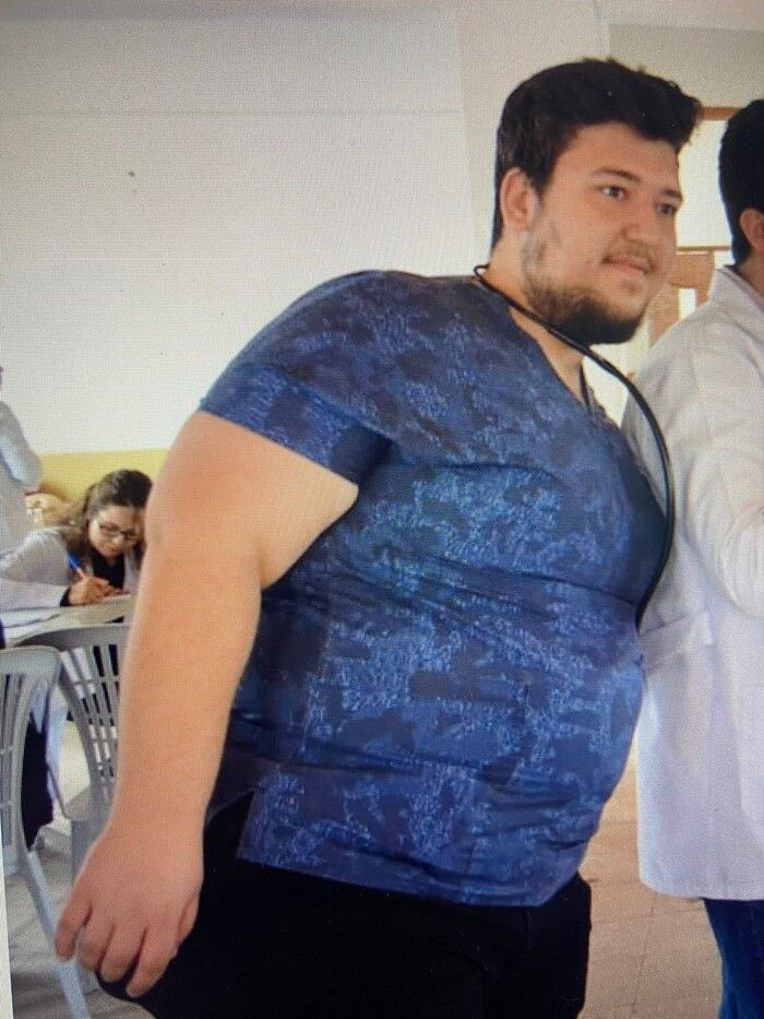 Ayakta bile zor duruyordu! 8 ayda 50 kilo verdi: Doktor adayının son halini gören şaştı kaldı - Resim: 1