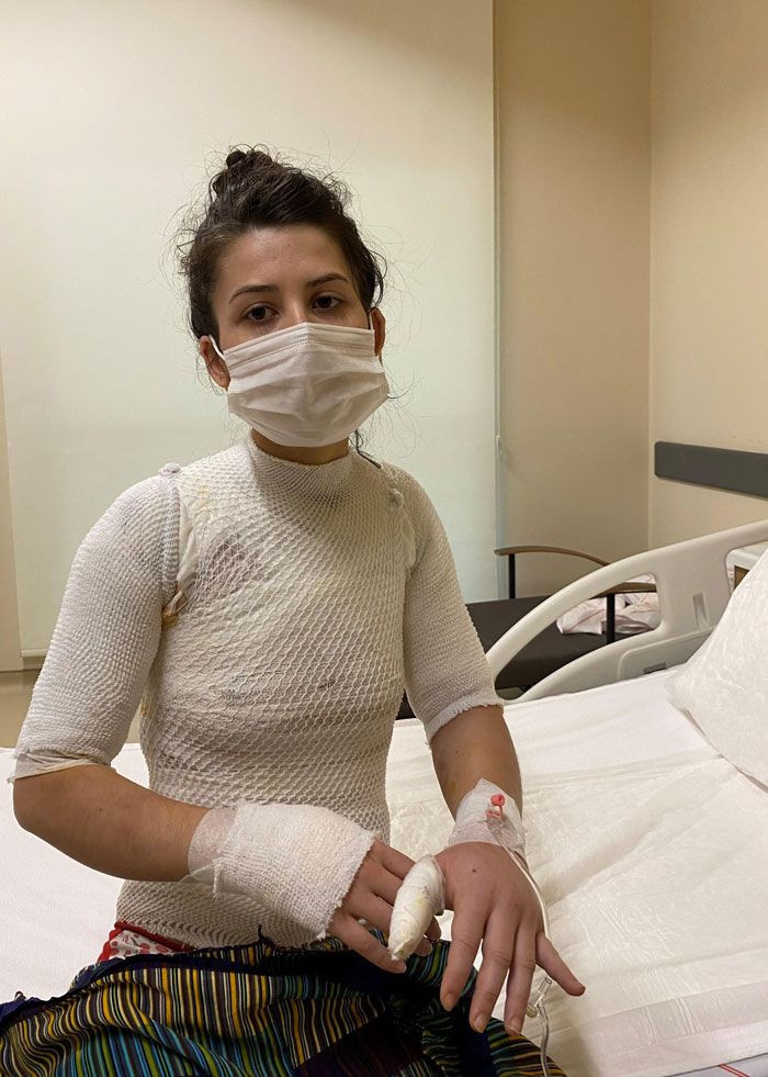 Eşinin sıcak suyla haşladığı Rukiye 1,5 yaşındaki kızının kendisine söylediği sözlerle sarsıldı - Resim: 4