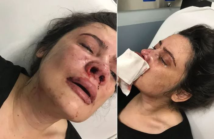 Derya Elbasan eşi tarafından feci şekilde dövüldü! Kızı Hira Elbasan isyan etti - Resim: 1