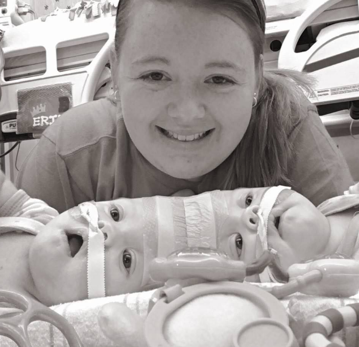 Bu halde doğdular doktorları bile şaşkına çevirdiler daha sonra da ... - Resim: 2