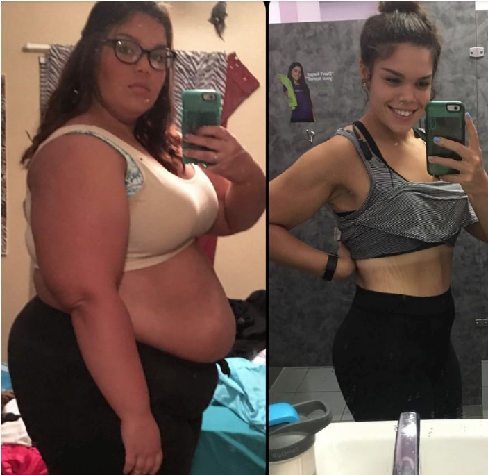 Sadece 2 şey yaptı tam 70 kilo verdi yok böyle değişim - Resim: 4