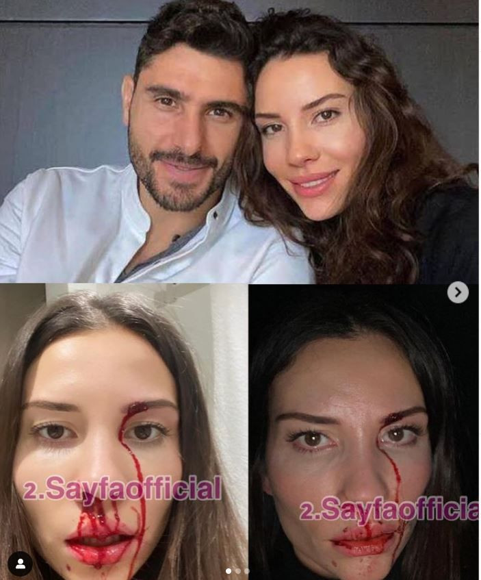 Özer Hurmacı Mihriban Hurmacı şiddet olayı ne ünlü futbolcudan son açıklama Mihriban Dinçer Hurmacı kimdir - Resim: 1