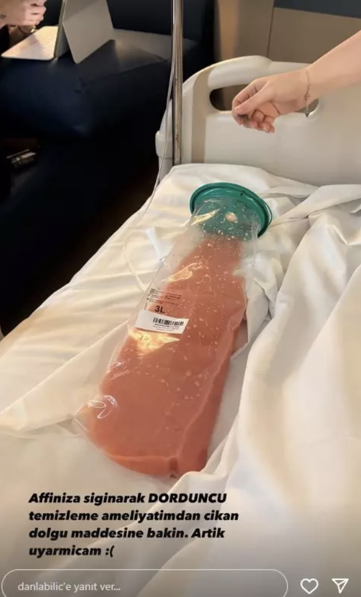 Danla Bilic'in kalçasından çıktı! Dolgu maddesi görenleri şaşkına çevirdi - Resim: 4