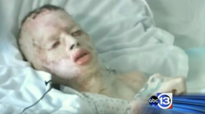 Bu hale getirdi 8 yaşındaki çocuğu ağaca bağlayıp önce diri diri yaktı sonra... - Resim: 3