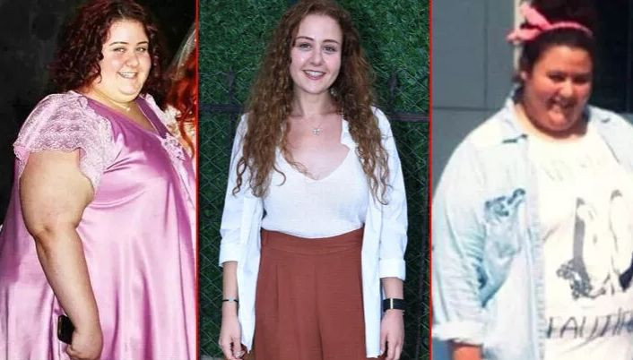 Mide ameliyatı sonrası 100 kilo veren Aslı Samat: Şişman bir kıza... - Resim: 1