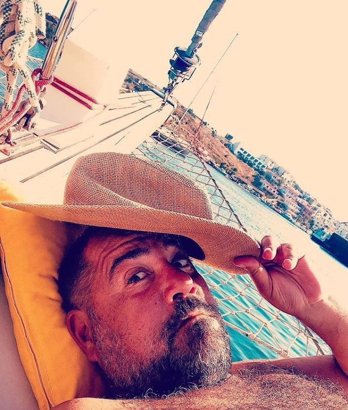 Ata Demirer kaza geçirdi ameliyata alındı işte son durumu - Resim: 4