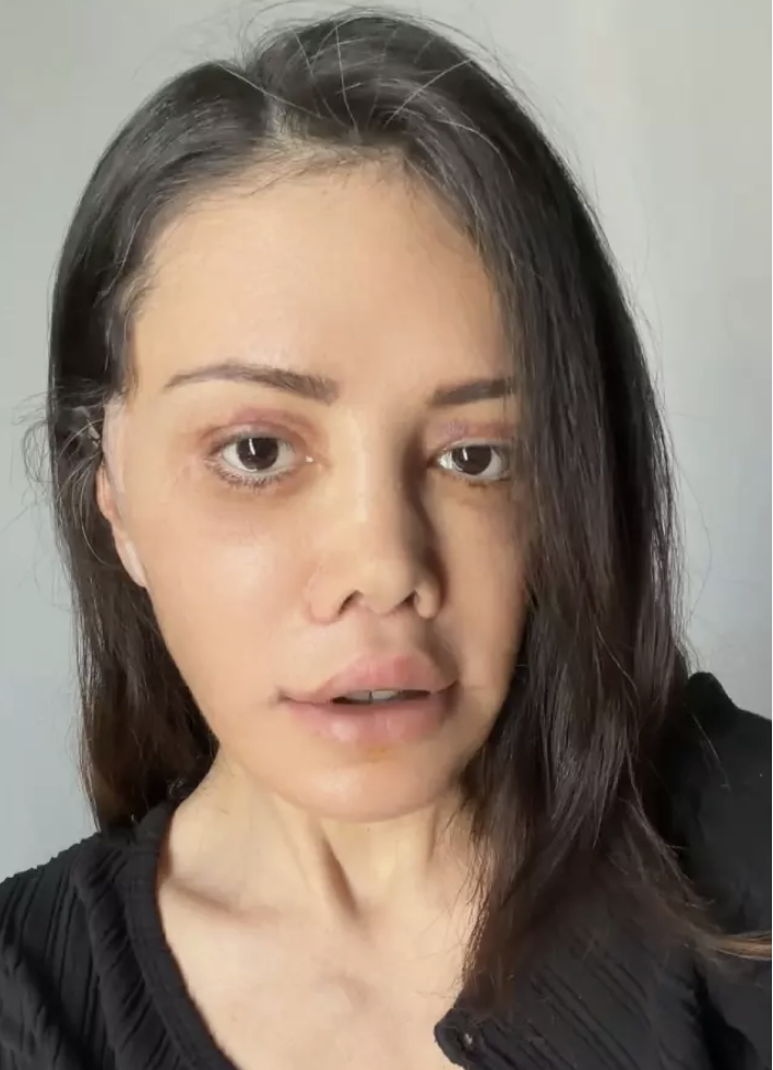 Didem Ceran sağlık durumunu açıkladı! Meğer o hastalıkla mücadele ediyormuş... - Resim: 3