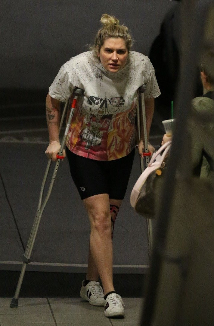 Ünlü şarkıcı görenleri şoke etti ne oldu böyle! - Resim: 3