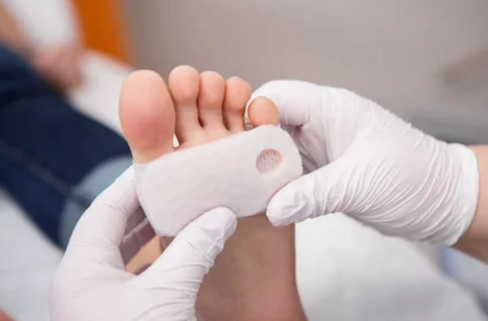 Düşük ayak sendromu nedir tedavisi var mı bel fıtığı olanlar için riskli! - Resim: 2