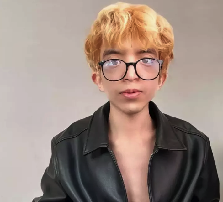 'Tablet Reis' adıyla tanınan Onurcan Güzel 5 ayrı yüz ameliyatı oldu, tanınmaz hale geldi! - Resim: 3