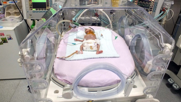 Parmak bebek hayata tutundu - Resim: 1