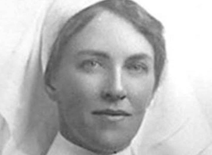 Yakalandığı hastalık sonrası bir anda dünyanın en çirkin kadını oldu - Resim: 1