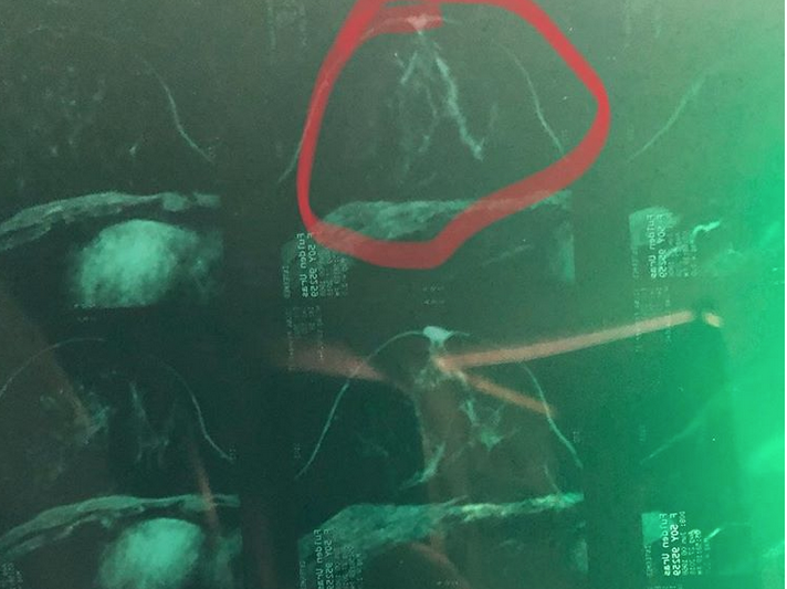 Fulden Uras kanser ameliyatında! Çıplak pozları bilinirdi iyilik meleği çıktı - Resim: 2