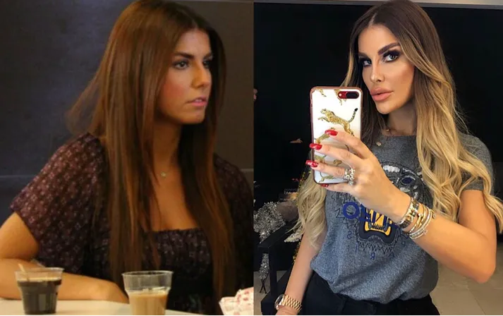 Estetiklerini açıkladı Adanalı dizisinin Pınar'ı Tuğçe Özbudak'dan samimi itiraflar - Resim: 1