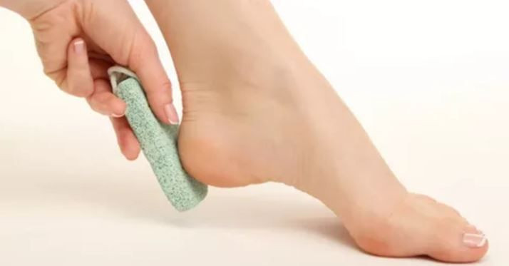 Topuk çatlaklarına ne iyi gelir evde tedavi edin! - Resim: 4