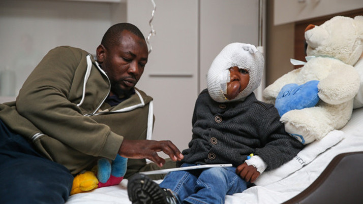 Küçük Mehdi sağlığına Türkiye’de kavuşacak yüzünün yarısını kapladı