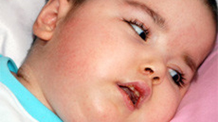 4 yaşında 39 kez ameliyat oldu