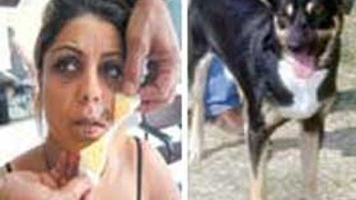 Köpekten tehlikeli öpücük!