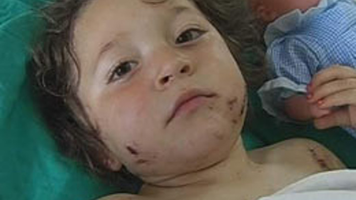 Köpek 4 yaşındaki kızı öldürüyordu