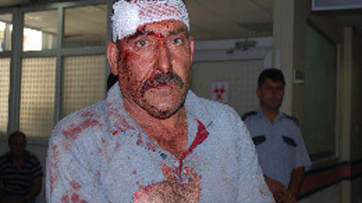 Boynuz darbeleri bu hale getirdi