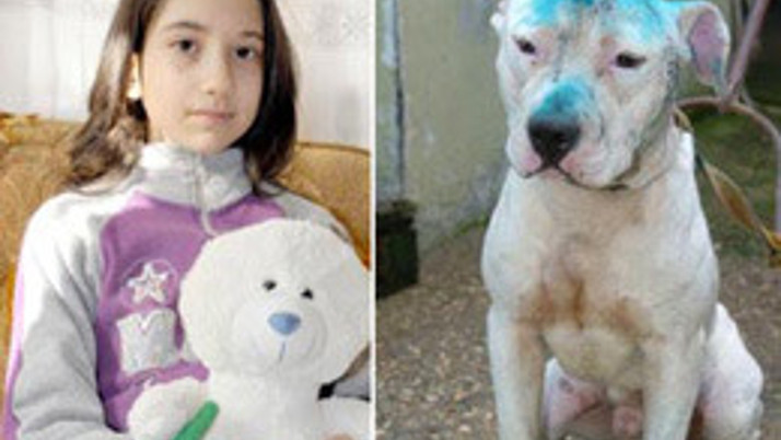 Pitbull minik kızı felç etti!