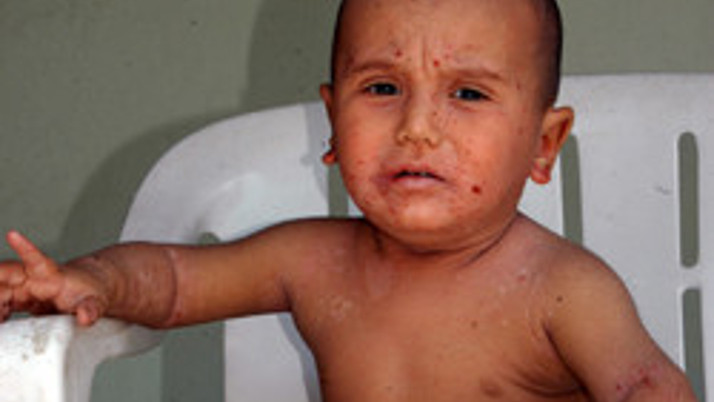 Küçük Enes yardım eli bekliyor