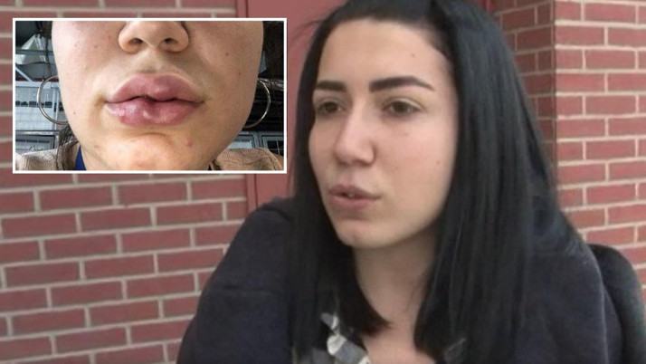 Ece Deniz estetik faciasını yaşamıştı her şeyi itiraf eden doktor suçlamaları reddetti