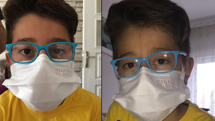 Kayseri'de küçük çocuğun hayatı karardı: Sürekli kendi gözüne yumruk atıyor