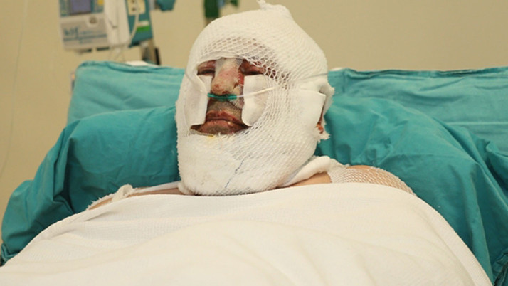 Denizli kahramanı konuştu! Orman yangının içinde son anda nasıl kurtuldu?