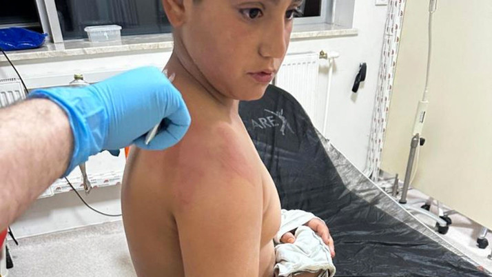 CHP seçim bürosunda 10 yaşındaki çocuğa kaynar çay fırlatıldı CHP'li başkandan açıklama