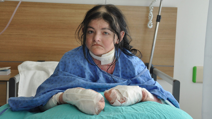 Parmakları bitişikti, ABD'li genç kız şifayı Eskişehir'de buldu! 2 ay içinde...