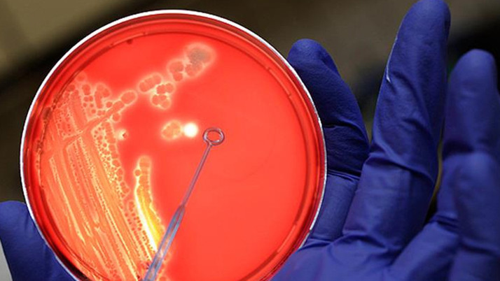 Ülkede bir hastalık tekrar hortladı! Yıllar sonra ilk ölüm