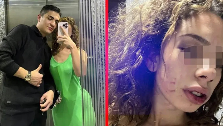 'Mezar ayarla' dedi, sevgilisini öldüresiye dövdü