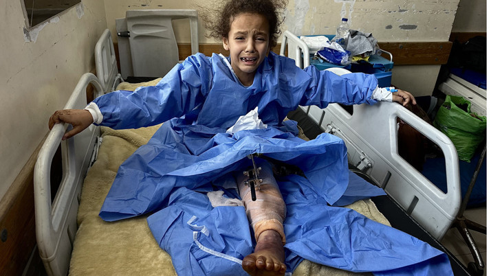 Sağ bacağını kaybetti sol bacağı da tehlikede Filistinli kızın yardım çığlığı