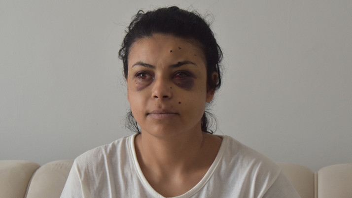 Pencereden düğünü izlerken dehşeti yaşadı! Tüfekten çıkan saçmalar genç kadına isabet etti