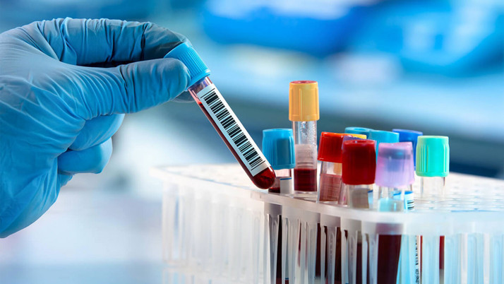 Akılcı Test İstem Listesi! Doktorlar sadece bu tahlilleri isteyebilecek