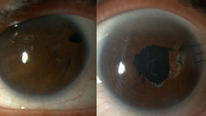 20 yıllık karanlığa neşter! Prof. Dr. Yusuf Yıldırım, “Zorlu ama mümkün” diyerek son noktayı koydu