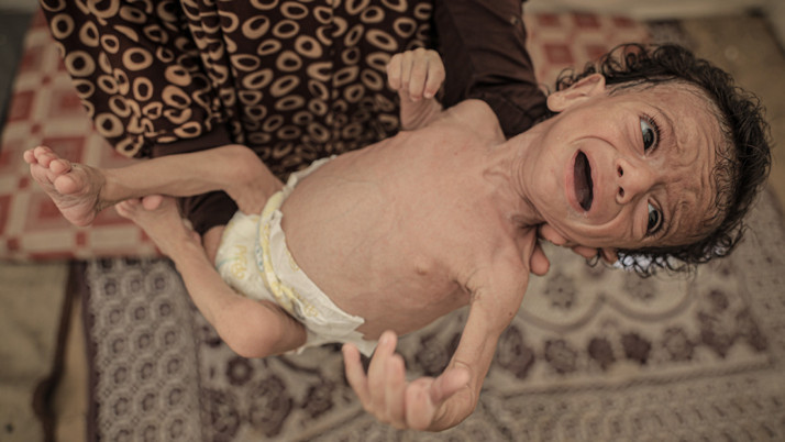 BM yetkilisi, Gazze'deki korkunç durumu açıkladı kalıcı ateşkes çağrısı yaptı